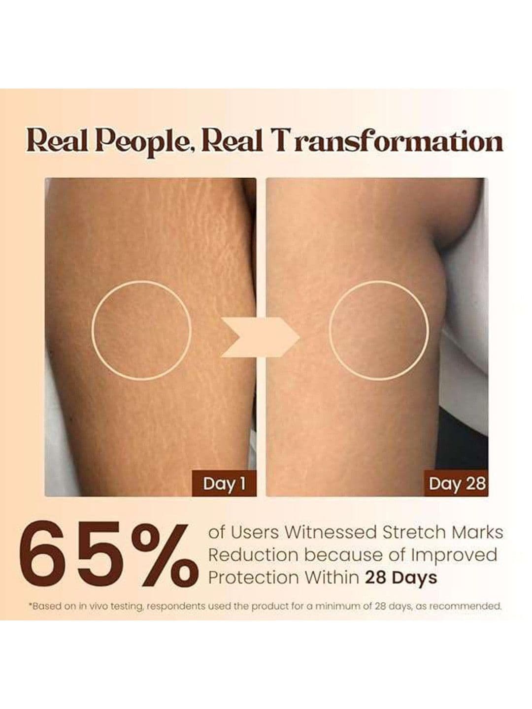 Pokonut Natural Stretch Mark Cream With Mulethi & Hyaluronic Acid - 50 g thumbnail 5
